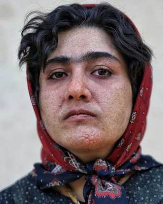 گریم سنگین باران کوثری در «بیهمهچیز» گریم سنگین باران کوثری در «بیهمهچیز»