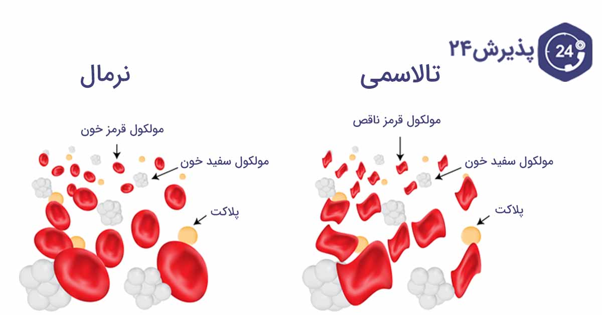 رفع کمبود دارویی بیماران تالاسمی فارس پیگیری شد رفع کمبود دارویی بیماران تالاسمی فارس پیگیری شد