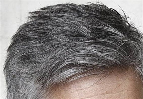 موهای سفید را با این خوردنی ها از بین ببرید موهای سفید را با این خوردنی ها از بین ببرید