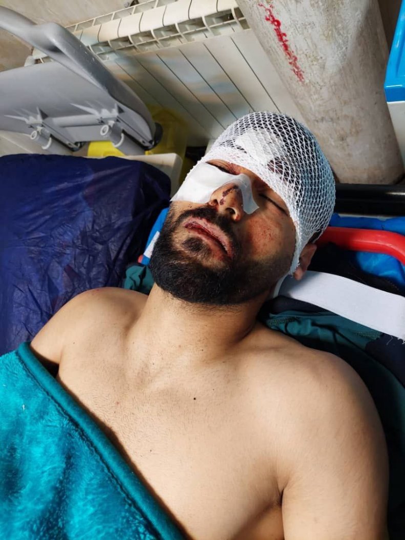 حادثه برای مدافع ملی پوش حادثه برای مدافع ملی پوش