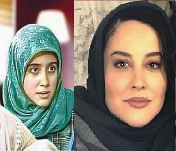 (عکس) چهره خانم بازیگر پس از عمل جراحی (عکس) چهره خانم بازیگر پس از عمل جراحی