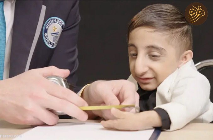جوان ایرانی با کوچکترین دستهای دنیا رکورد زد + عکس جوان ایرانی با کوچکترین دستهای دنیا رکورد زد + عکس