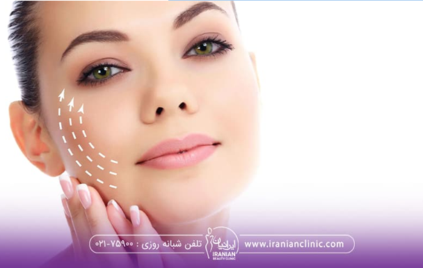 قیمت اندولیفت در سال ۱۴۰۳ چقدر است؟ قیمت اندولیفت در سال ۱۴۰۳ چقدر است؟