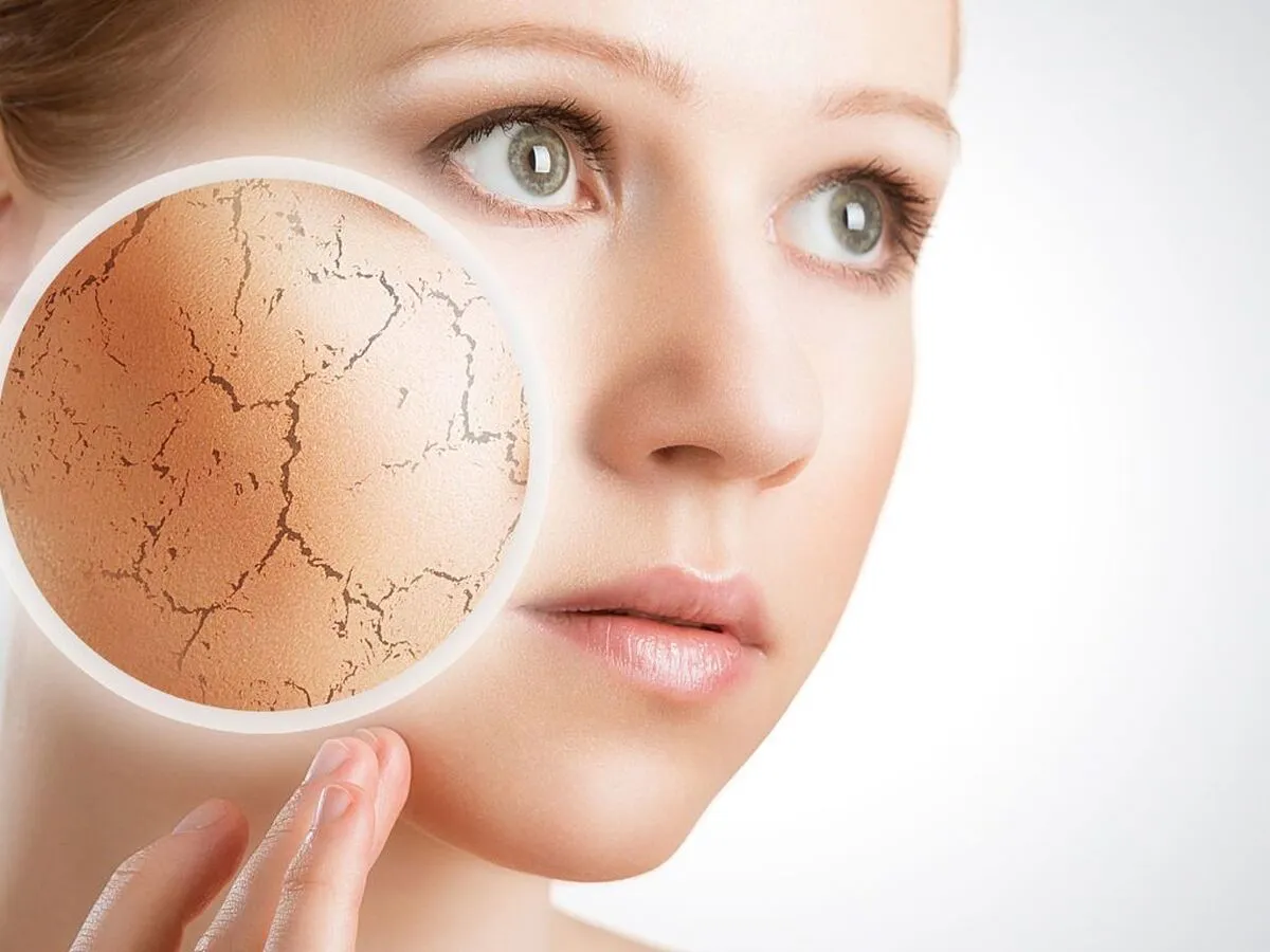 چگونه از خشکی پوست در روز‌های سرد جلوگیری کنیم؟