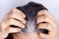 راهکار جلوگیری از خاکستری شدن مو‌ها