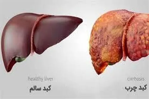 نشستن زیاد می&zwnj;تواند به کبد کودکان آسیب برساند؟