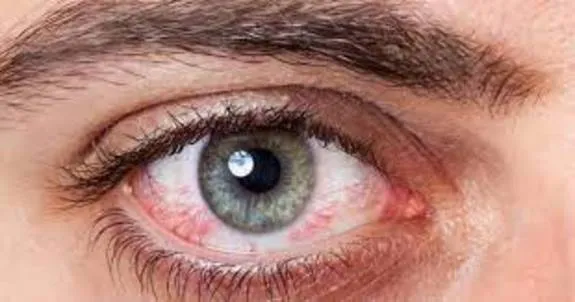 راهکارهایی برای مراقبت از سلامت چشم