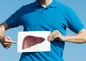 تمام باور‌های غلط در مورد درمان کبد چرب