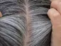 دلیل سفید شدن مو‌ها چیست؟