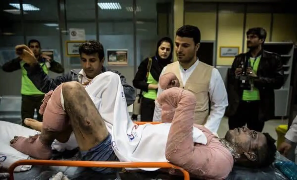 درمان هر یک درصد سوختگی ۱۰ میلیون تومان!