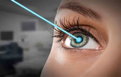 رنک چشم هم قابل تغییر است؟