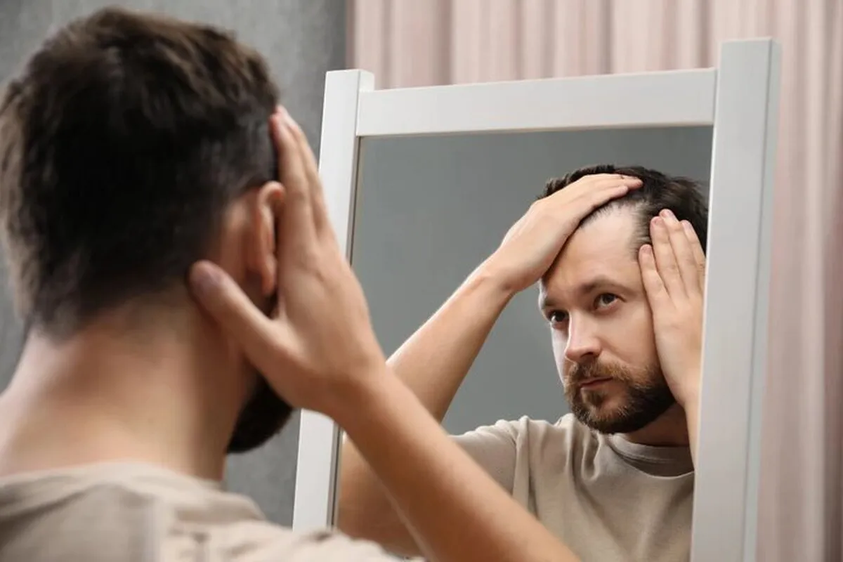 با این کار جلوی کچلی را بگیرید