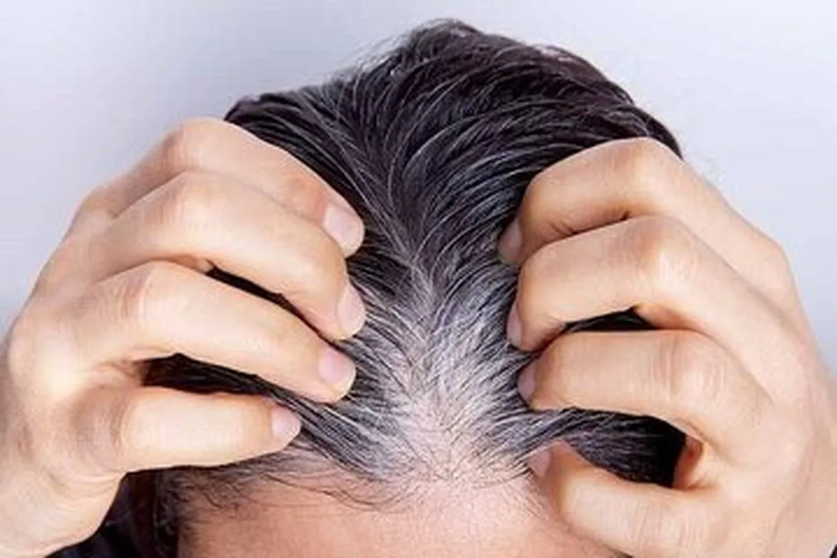 راهکار جلوگیری از خاکستری شدن مو‌ها