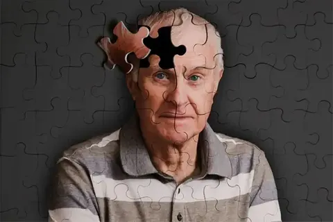بیماری آلزایمر: علائم، علل، پیشگیری و مدیریت زندگی روزمره