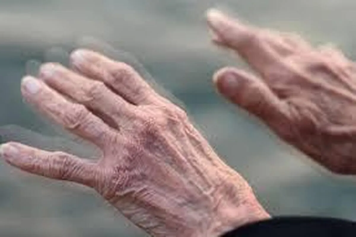 ۷ عامل تشدید کننده پارکینسون