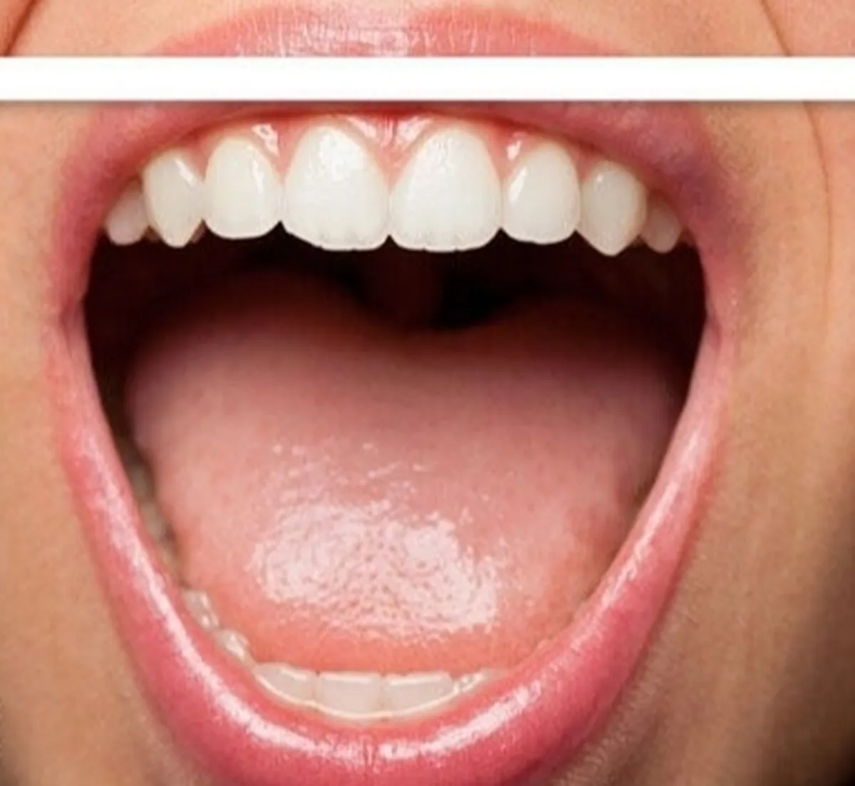 بی حسی زبان را جدی بگیریم