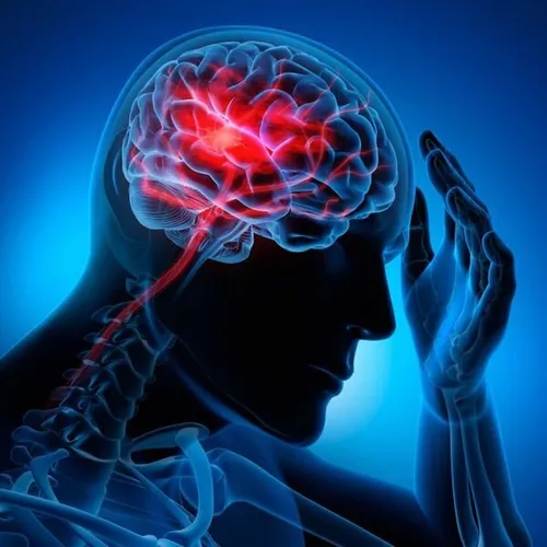 عوامل افزایش سکته&zwnj;های مغزی در جهان