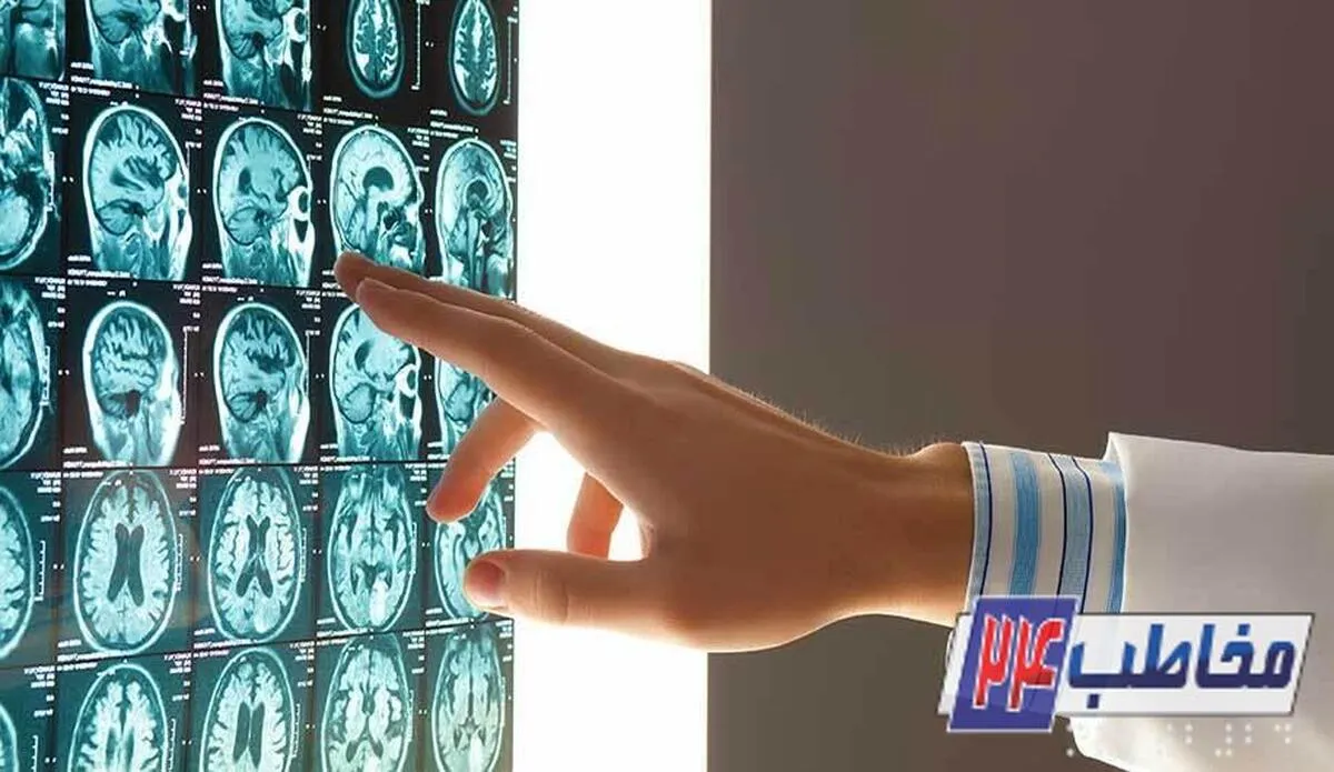 چگونه سکته مغزی نکنیم ؟ ۶ راه طلایی برای کاهش سکته مغزی