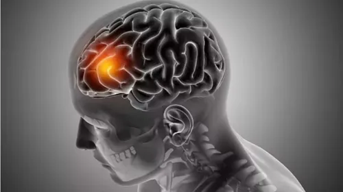 ضربه مغزی چه علائمی دارد؟