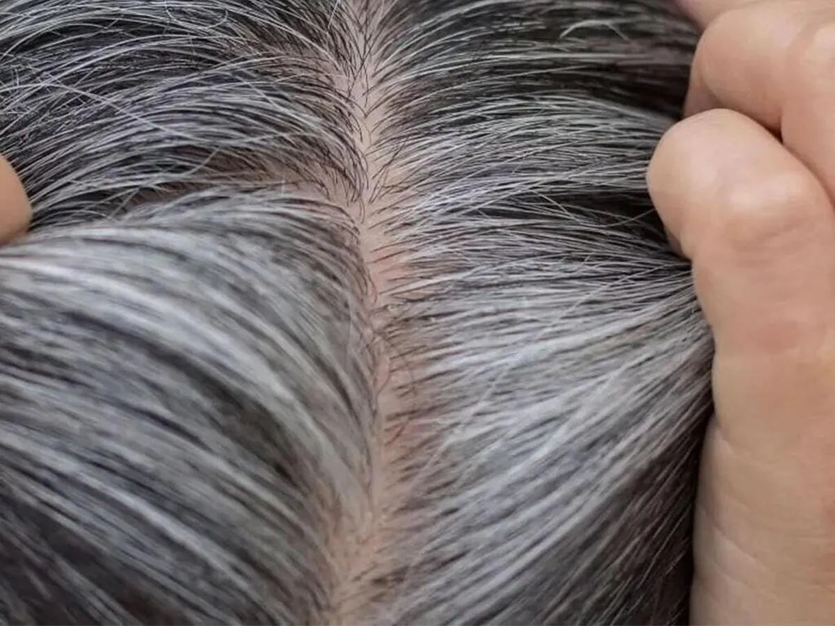 دلیل سفید شدن مو‌ها چیست؟