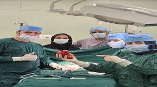 خروج تومور ۱۴ سانتی از کلیه کودک بندرعباسی