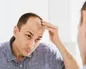 ۹ راهکار ساده برای جلوگیری از ریزش مو